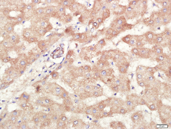 ALDH1 Antibody in Immunohistochemistry (Paraffin) (IHC (P))