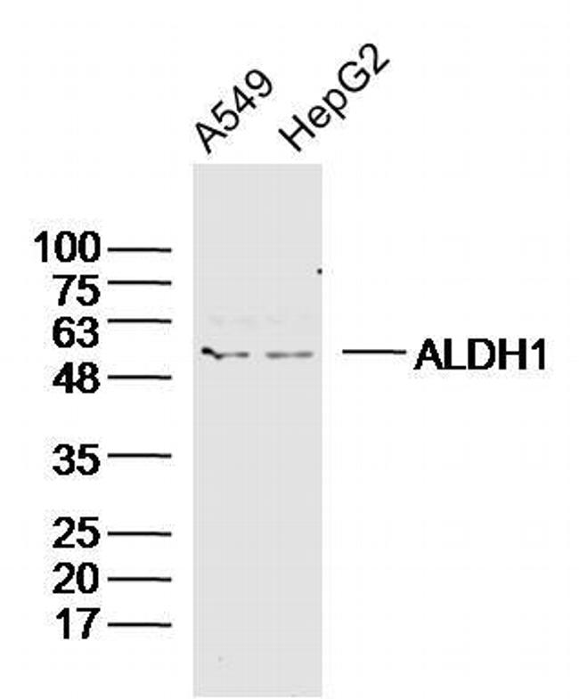 ALDH1 Antibody in Western Blot (WB)