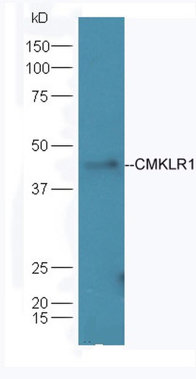 CMKLR1 Antibody in Western Blot (WB)