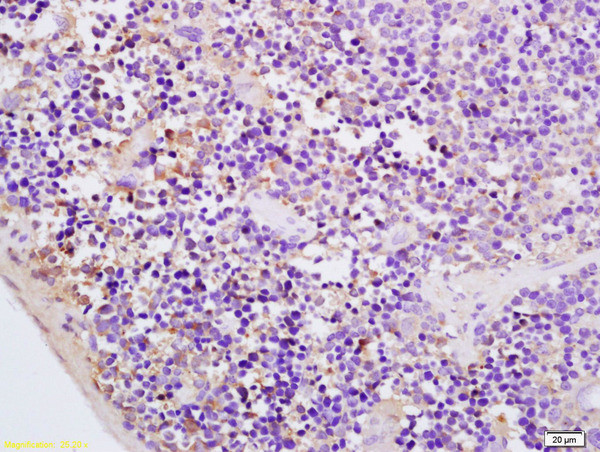 CMKLR1 Antibody in Immunohistochemistry (Paraffin) (IHC (P))