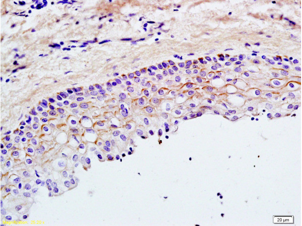 TLR2 Antibody in Immunohistochemistry (Paraffin) (IHC (P))