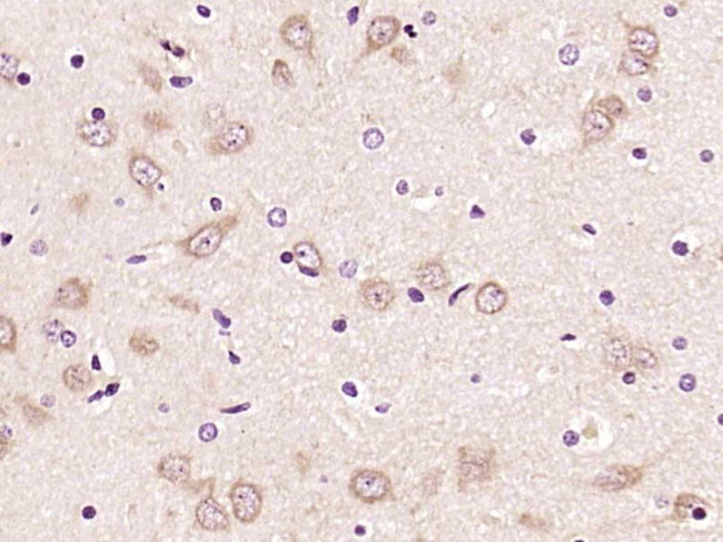 TLR2 Antibody in Immunohistochemistry (Paraffin) (IHC (P))