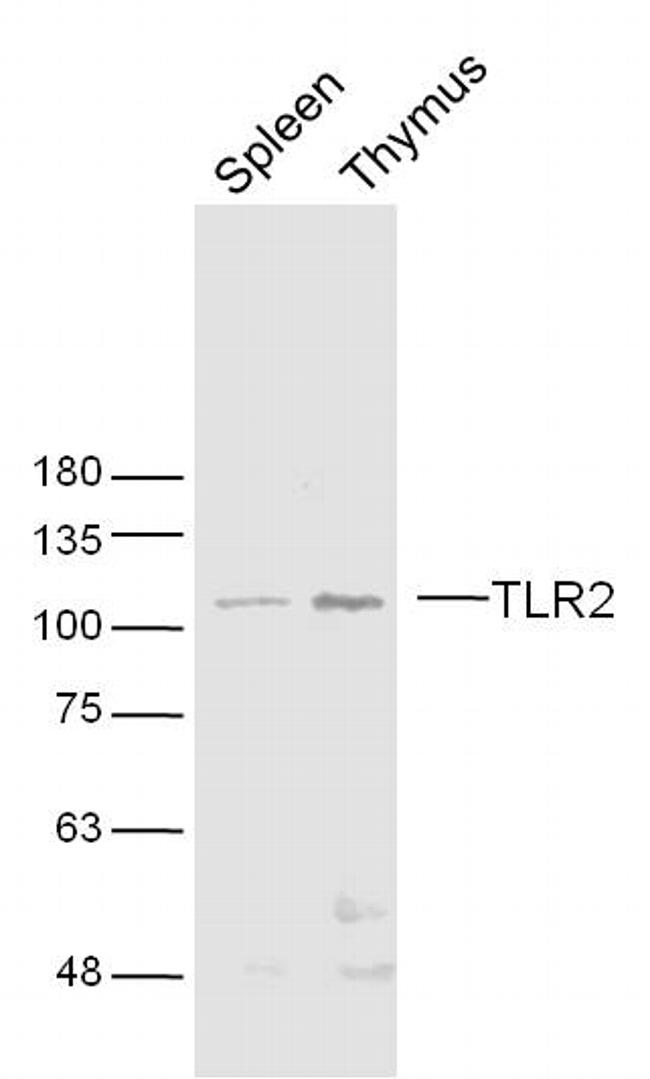 TLR2 Antibody in Western Blot (WB)