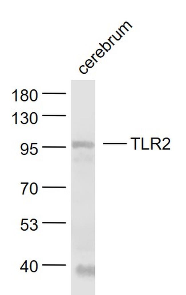 TLR2 Antibody in Western Blot (WB)