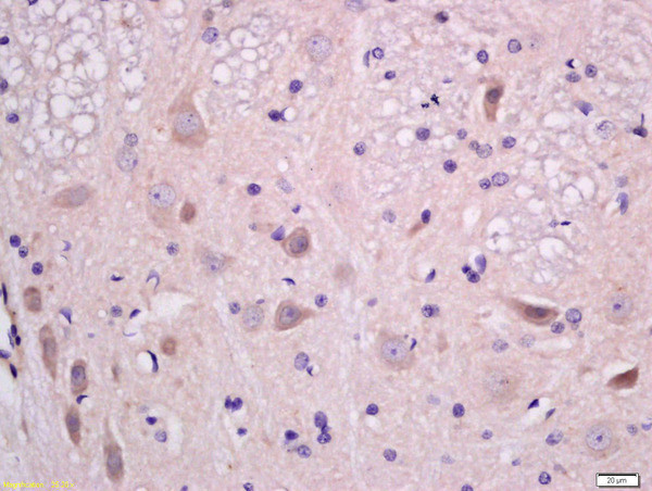 EPHA2 Antibody in Immunohistochemistry (Paraffin) (IHC (P))