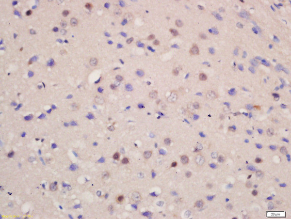 SOD1 Antibody in Immunohistochemistry (Paraffin) (IHC (P))