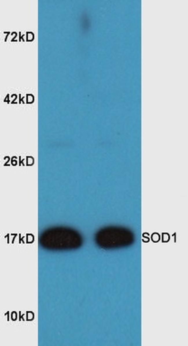 SOD1 Antibody in Western Blot (WB)