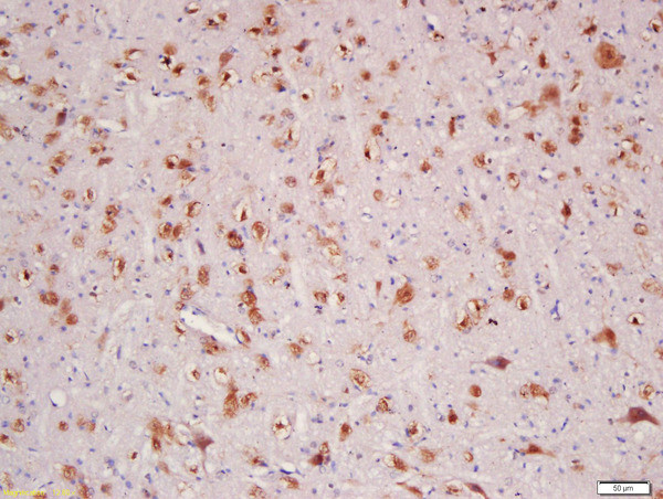 HER4/ErbB4 Antibody in Immunohistochemistry (Paraffin) (IHC (P))