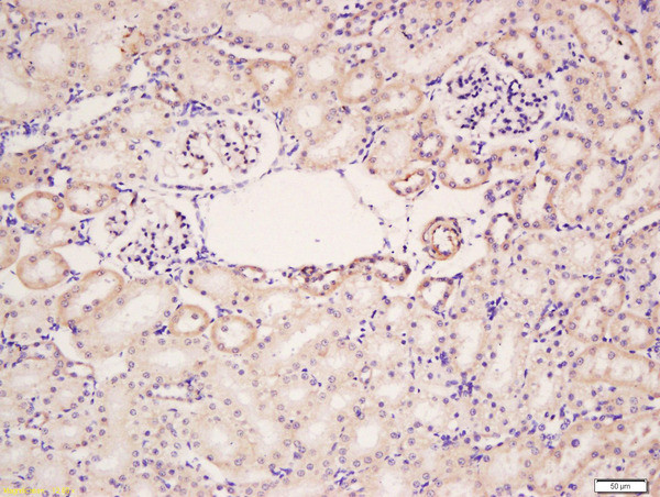 HER4/ErbB4 Antibody in Immunohistochemistry (Paraffin) (IHC (P))