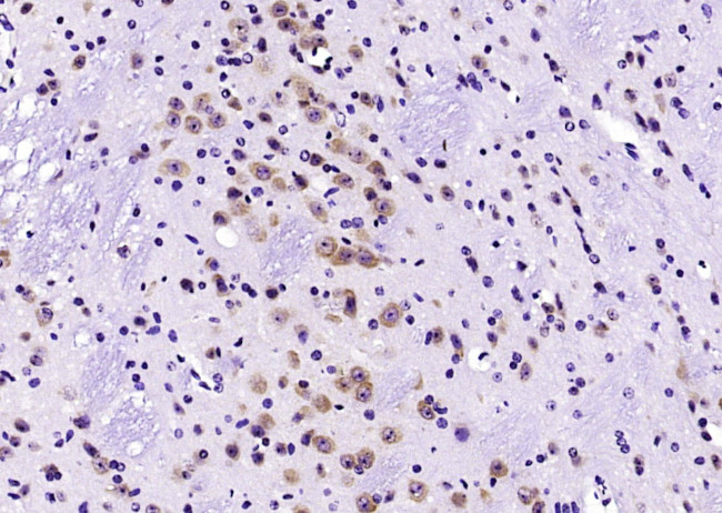 HER4/ErbB4 Antibody in Immunohistochemistry (Paraffin) (IHC (P))