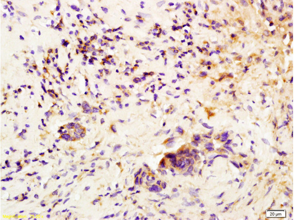 CSF3 Antibody in Immunohistochemistry (Paraffin) (IHC (P))