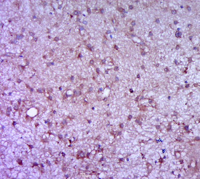 CSF3 Antibody in Immunohistochemistry (Paraffin) (IHC (P))