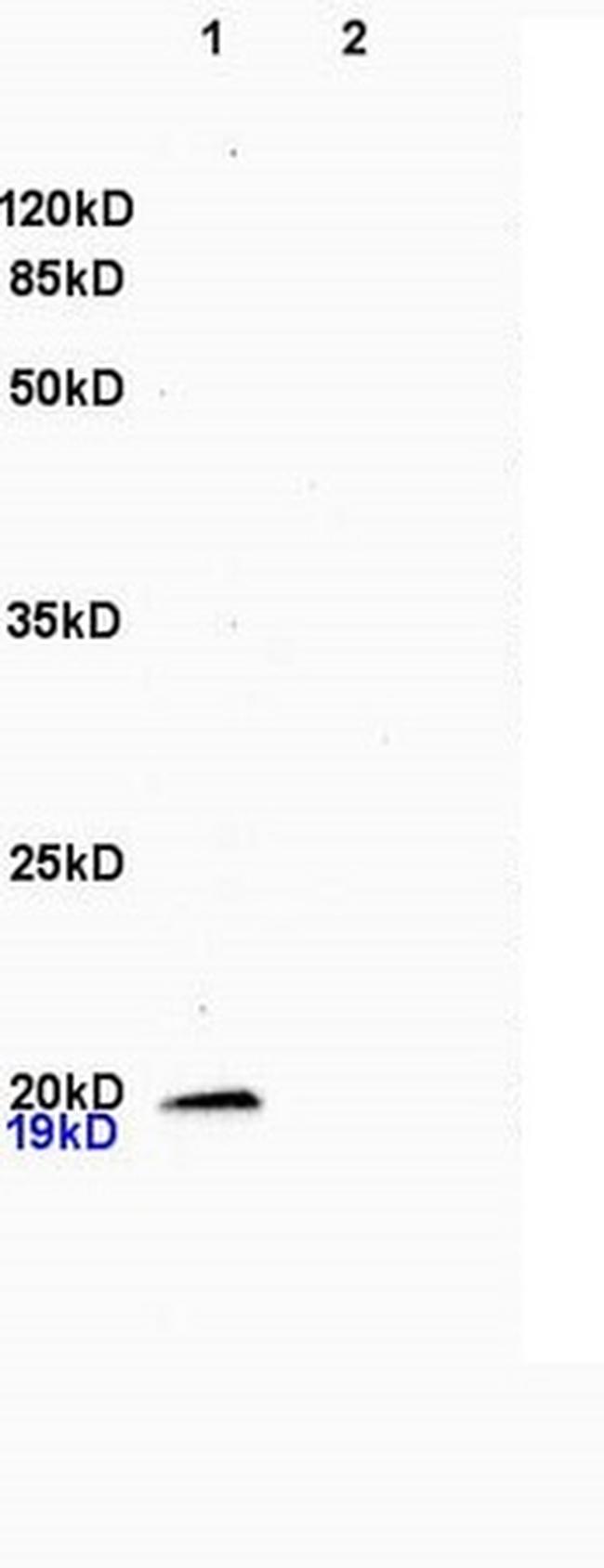 CSF3 Antibody in Western Blot (WB)