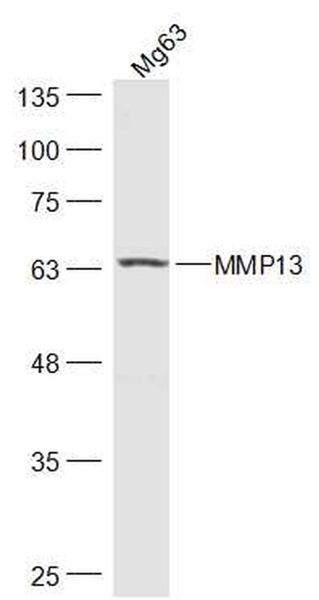 MMP13 Antibody in Western Blot (WB)