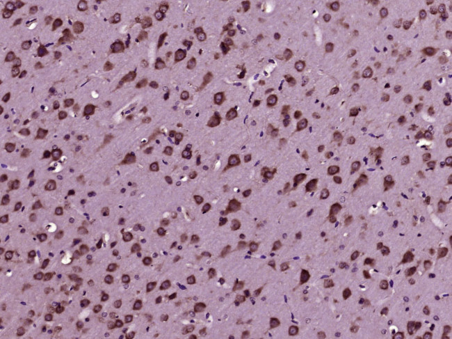 CDK5 Antibody in Immunohistochemistry (Paraffin) (IHC (P))