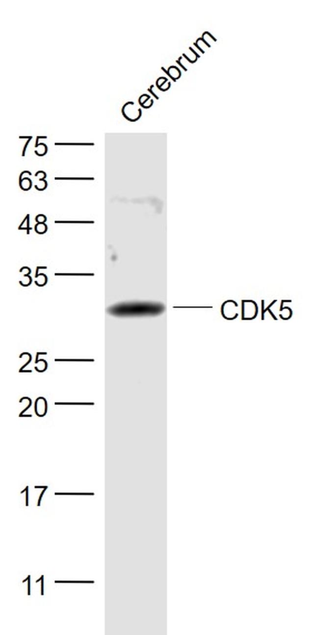 CDK5 Antibody in Western Blot (WB)