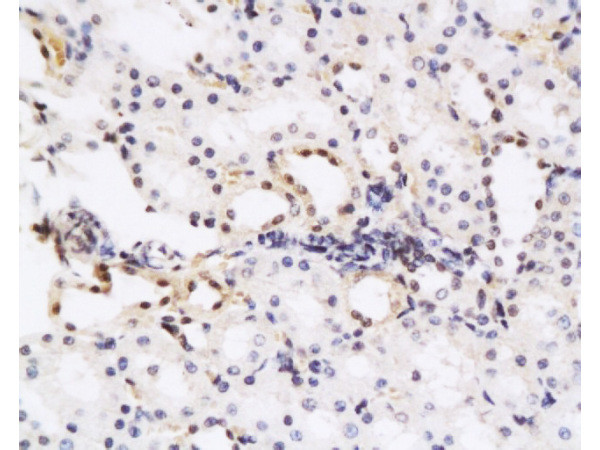 HGF Antibody in Immunohistochemistry (Paraffin) (IHC (P))