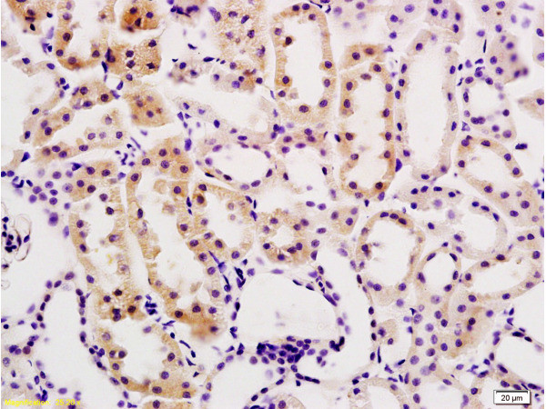 Desmin Antibody in Immunohistochemistry (Paraffin) (IHC (P))