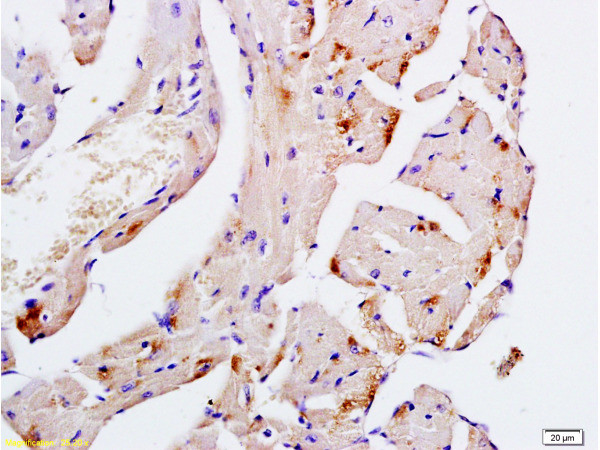 Desmin Antibody in Immunohistochemistry (Paraffin) (IHC (P))