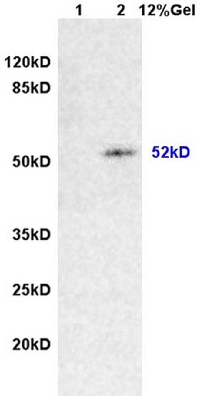 Desmin Antibody in Western Blot (WB)