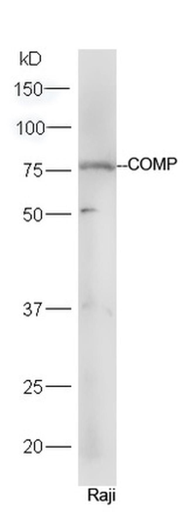 COMP Antibody in Western Blot (WB)