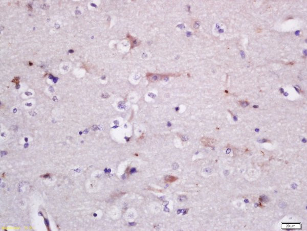 GADD34 Antibody in Immunohistochemistry (Paraffin) (IHC (P))