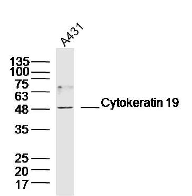 Cytokeratin 19 Antibody in Western Blot (WB)