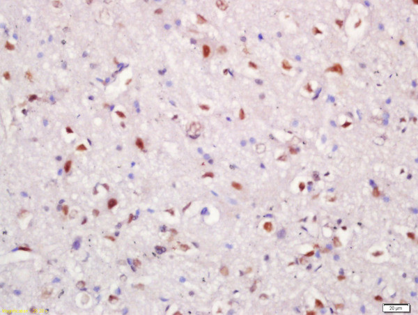 Hrk Antibody in Immunohistochemistry (Paraffin) (IHC (P))