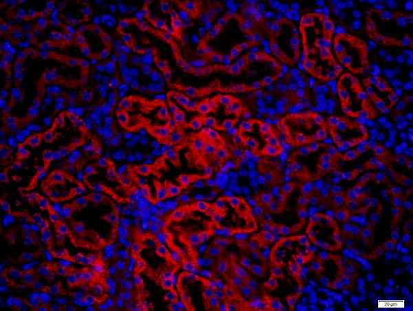 KRAS Antibody in Immunohistochemistry (Paraffin) (IHC (P))