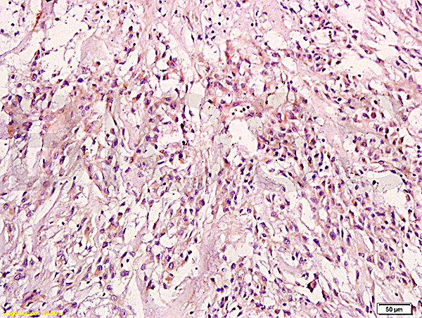 KRAS Antibody in Immunohistochemistry (Paraffin) (IHC (P))