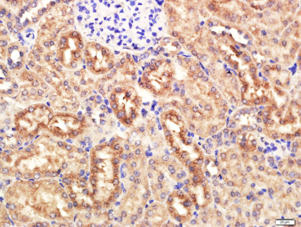 KRAS Antibody in Immunohistochemistry (Paraffin) (IHC (P))