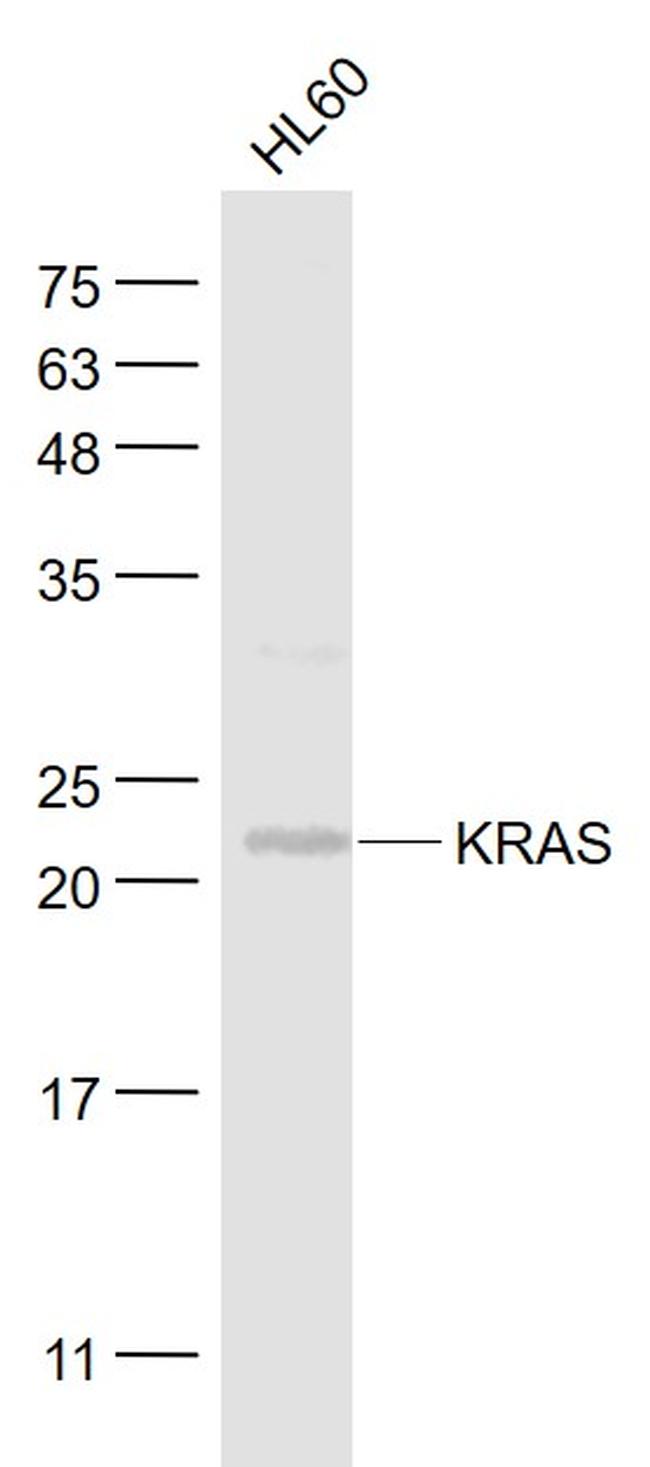 KRAS Antibody in Western Blot (WB)