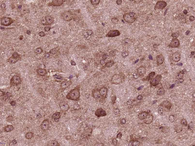 AMPK alpha-1 Antibody in Immunohistochemistry (Paraffin) (IHC (P))