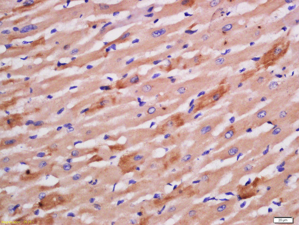 Sarcomeric Alpha Actinin Antibody in Immunohistochemistry (Paraffin) (IHC (P))