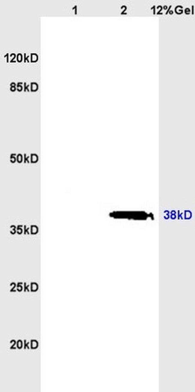 CD62L Antibody in Western Blot (WB)