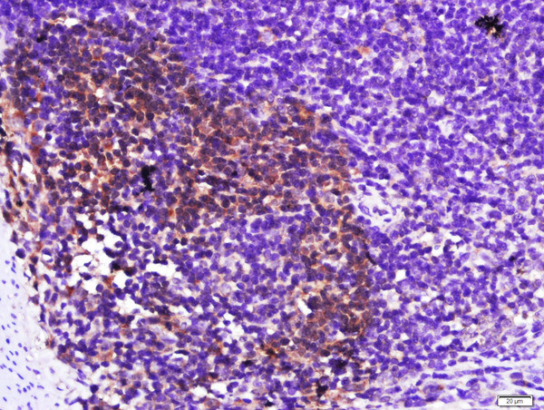 Galectin-3 Antibody in Immunohistochemistry (Paraffin) (IHC (P))