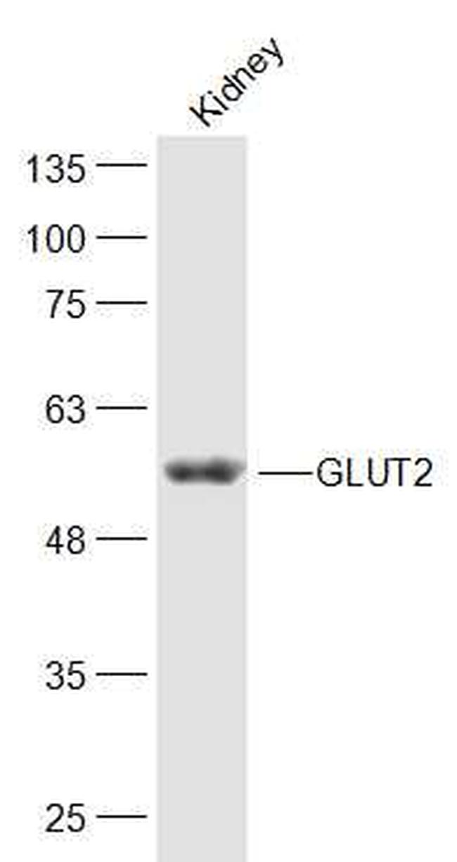 GLUT2 Antibody in Western Blot (WB)