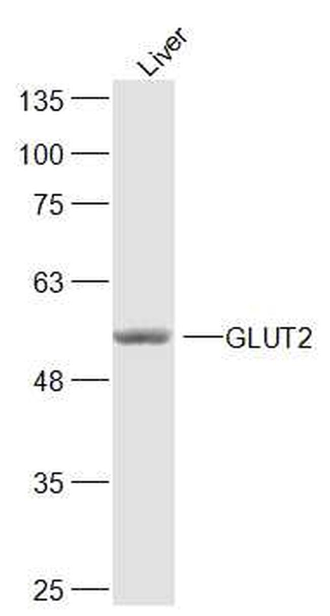 GLUT2 Antibody in Western Blot (WB)