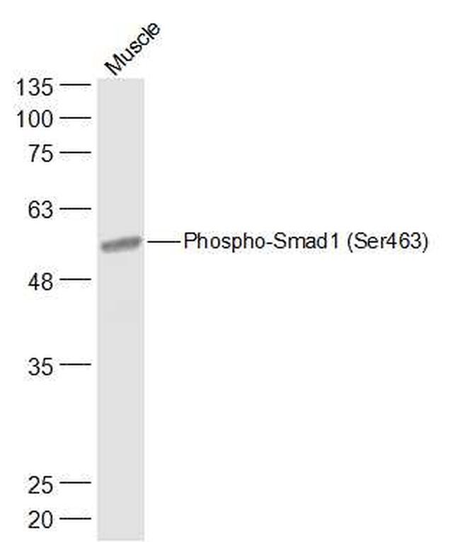 Phospho-Smad1 (Ser463) Antibody in Western Blot (WB)