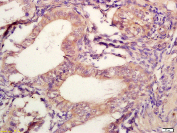 TIMP-2 Antibody in Immunohistochemistry (Paraffin) (IHC (P))