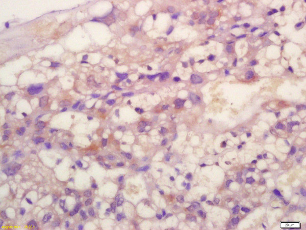 TIMP-2 Antibody in Immunohistochemistry (Paraffin) (IHC (P))