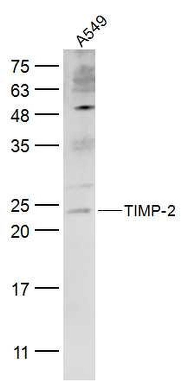 TIMP-2 Antibody in Western Blot (WB)