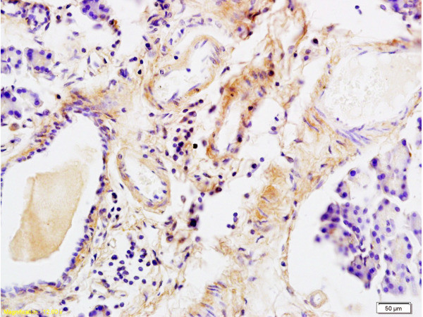 Tenascin C Antibody in Immunohistochemistry (Paraffin) (IHC (P))