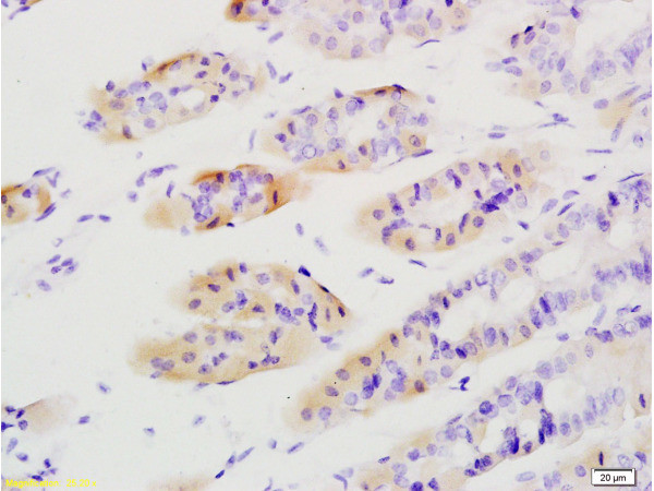 Tenascin C Antibody in Immunohistochemistry (Paraffin) (IHC (P))