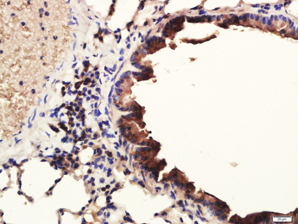 Pan Cytokeratin/p-CK Antibody in Immunohistochemistry (Paraffin) (IHC (P))