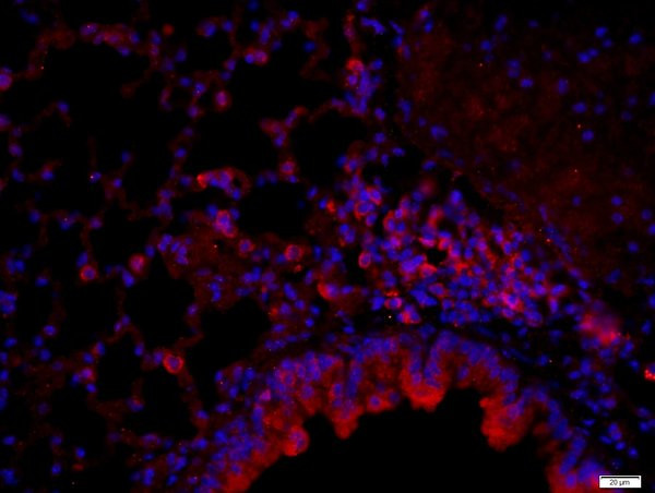 Pan Cytokeratin/p-CK Antibody in Immunohistochemistry (Paraffin) (IHC (P))