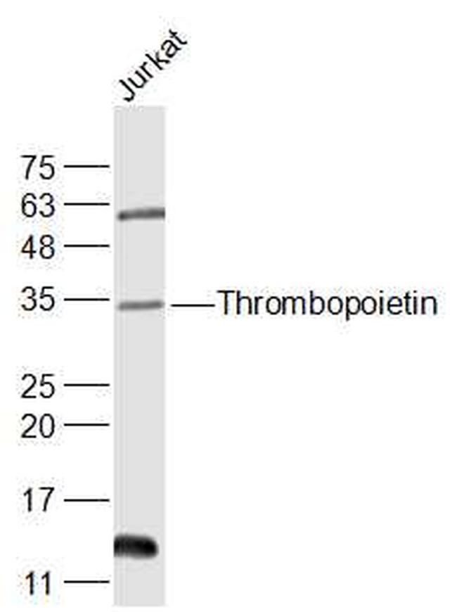 Thrombopoietin Antibody in Western Blot (WB)
