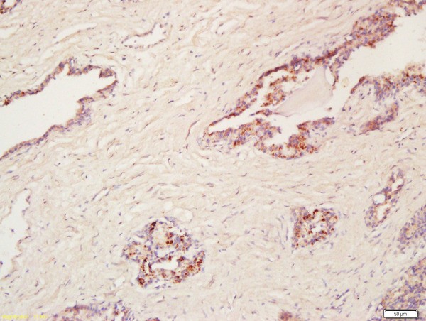 Cyclooxygenase 2 Antibody in Immunohistochemistry (Paraffin) (IHC (P))