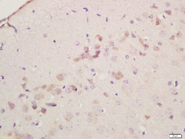 Cyclooxygenase 2 Antibody in Immunohistochemistry (Paraffin) (IHC (P))