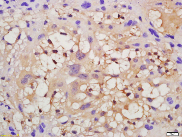 VEGFR2 Antibody in Immunohistochemistry (Paraffin) (IHC (P))